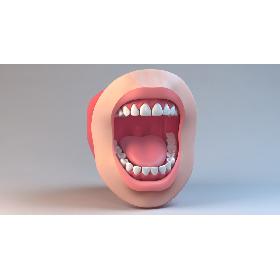 Orthodontic Mouth